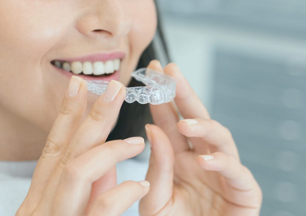 İnvisalign Hangi Dişlere Uygulanır?