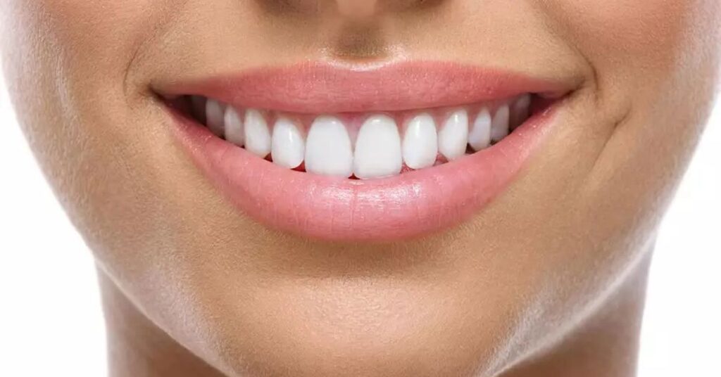 Zirkonyum İmplant Nedir? Zirkonyum İmplant Nedir?