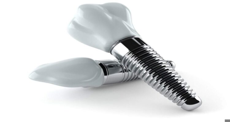 Zirkonyum İmplant Nedir?